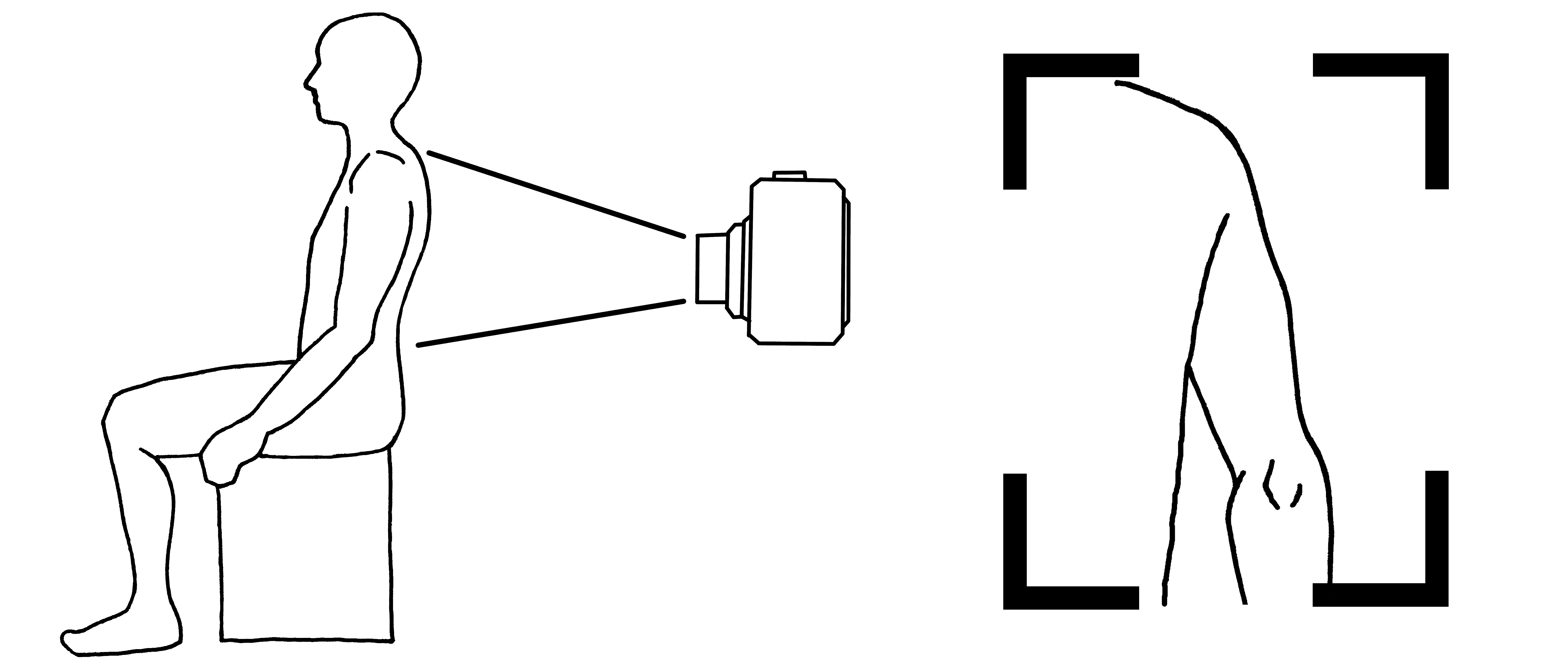 upper arm diagram and example