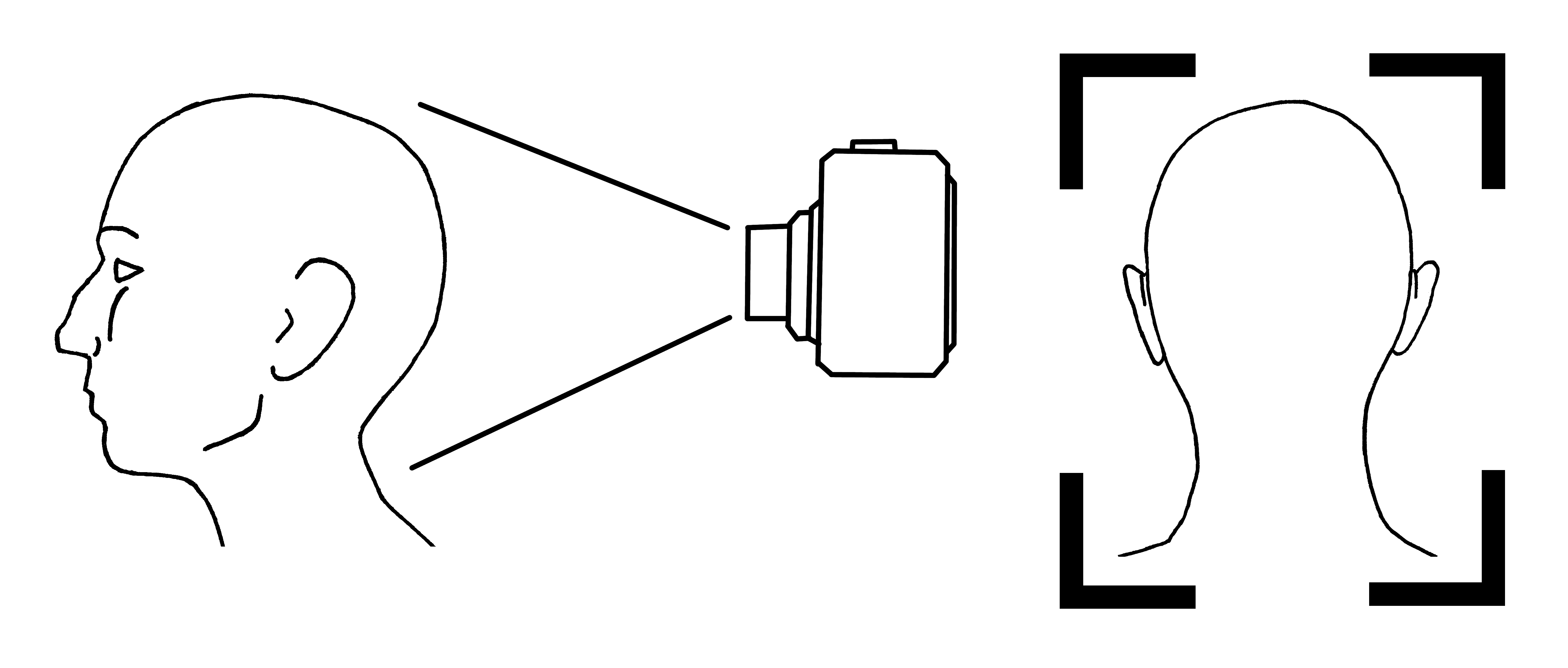 back of skull diagram and example